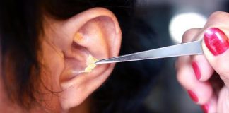 ภาวะ ขี้หูอุดตัน